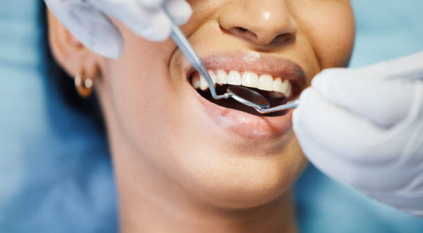 Best Walk-In Emergency Dental Services in Benton, LA