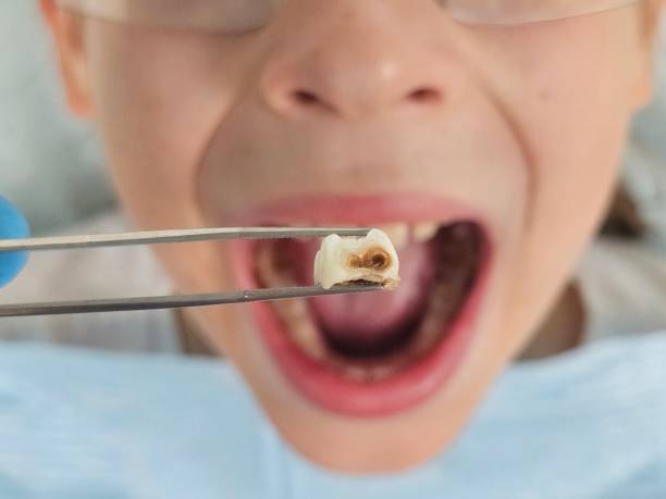 Best Emergency Pediatric Dental Care in Benton, LA